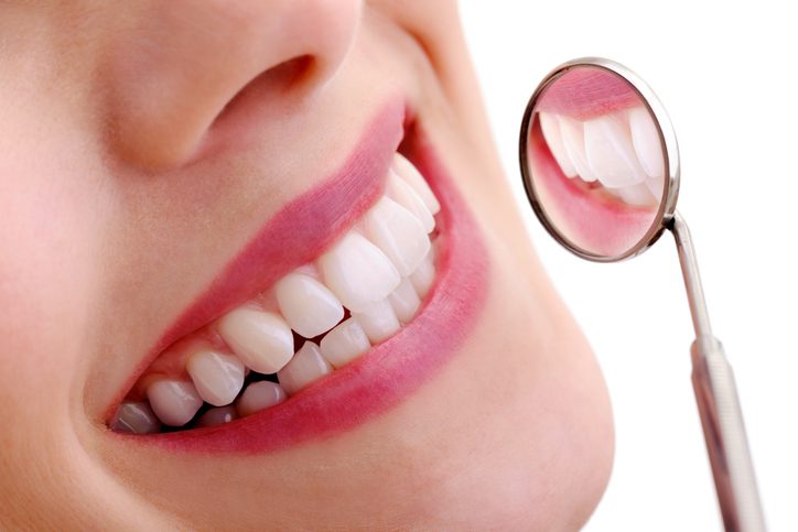 Teeth Whitening in Towson MD