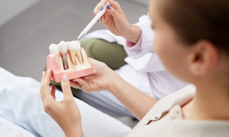 If you're considering a dental implant, knowing what to expect can help ease anxiety and prepare you for the journey ahead.